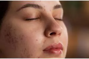 Tanpa produk eksfoliasi, ini cara kecilkan pori-pori wajah agar tampak mulus pakai scrub dari 2 buah