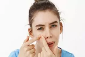 Bukan pakai putih telur, ini cara mengatasi pori-pori tersumbat dengan 1 jenis pemanis alami