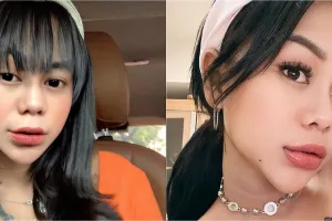 Penampilan terbarunya manglingi, 9 potret Cimoy Montok usai permak hidung ini tuai pro dan kontra