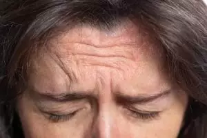 Tanpa beli produk antiaging, ini trik samarkan kerutan di wajah sensitif pakai 1 makanan alternatif