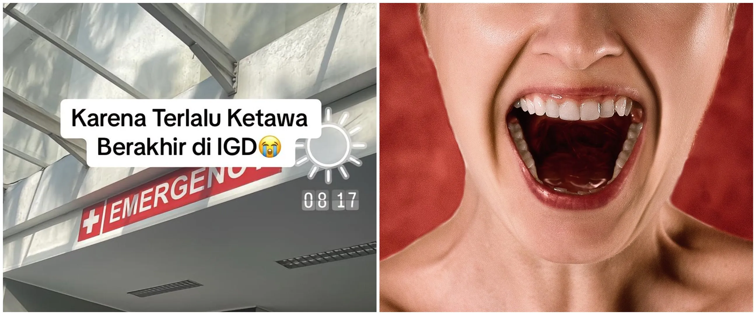 Tertawa bawa petaka, cerita pasien tak bisa bicara usai terbahak-bahak hingga dibawa ke IGD