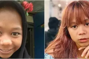 Disebut makin mirip Igun, intip 11 transformasi Cimoy Montok dari dulu hingga kini usai operasi hidung