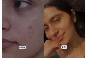 Cerah dalam 2 minggu, ini trik pudarkan noda hitam di wajah pakai 2 jenis rempah