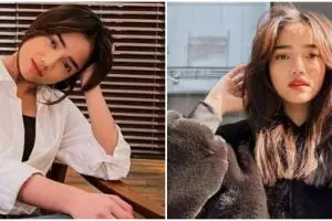 Fuji akui idap ADHD sejak lama, anggap gangguan mentalnya bukan aib melainkan berkah