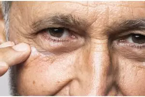 Hasilnya terlihat dalam 7 hari, ini cara membuat minuman kolagen untuk atasi keriput pakai 1 buah