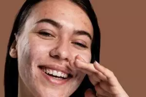 Bikin bebas komedo dan jerawat, ini cara atasi wajah berminyak pakai masker dari 1 jenis rempah