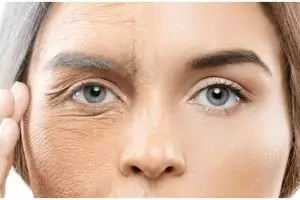 Tanpa tambahan jahe, ini trik menghaluskan wajah penuh kerutan pakai krim kolagen dari 1 jenis buah