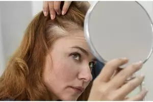 Tak perlu ditambah minyak argan, ini cara menumbuhkan rambut botak di area dahi pakai 1 bahan rempah