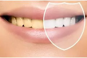 Tanpa baking soda, ini cara memutihkan gigi penuh noda kuning pakai tambahan 1 bahan dapur