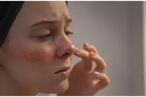 Tanpa petroleum jelly, ini cara menghidrasi kulit kering bikin auto lembap pakai toner dari 1 sayur