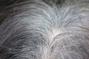 Tanpa pewarna kimia, ini cara menghitamkan kembali uban prematur secara alami pakai 1 jenis minuman