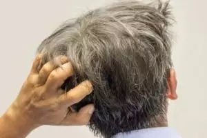 Hitam merata dikira pakai semir, ini trik hilangkan rambut beruban hanya dengan 1 bumbu dapur