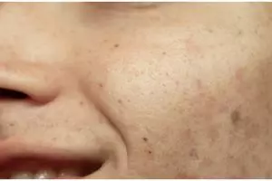 Cara mengecilkan pori-pori wajah agar kulit tampak mulus ini hanya pakai toner dari 1 jenis makanan