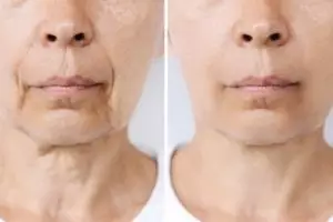 Tanpa flaxseed, ini trik kencangkan kulit wajah kendur penuh keriput pakai 1 bubuk minuman