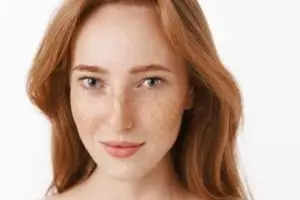 Nggak cuma pakai susu, ini cara atasi flek hiperpigmentasi wajah pakai tambahan 1 bahan minuman