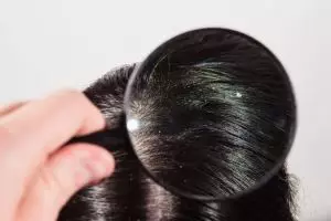 Bersih tanpa harus ke salon, ini trik usir ketombe dan rasa gatal di rambut pakai 1 jenis buah