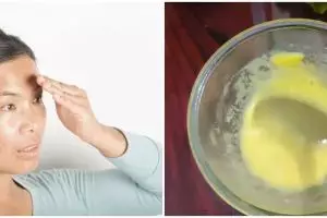 Tanpa lemon dan lidah buaya, ini cara putihkan pigmentasi akibat sinar matahari pakai 1 jenis tepung