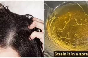 Rambut kuat dan antiketombe, ini trik atasi rontok dan kulit kepala kotor pakai 1 jenis rempah