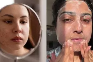 Bebas kusam tanpa kunyit, ini cara mencerahkan wajah dari flek hitam pakai 1 bahan dapur