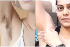 Tanpa deodorant, ini cara memutihkan ketiak yang hitam pekat dan berbau pakai gel dari 1 jenis tanaman