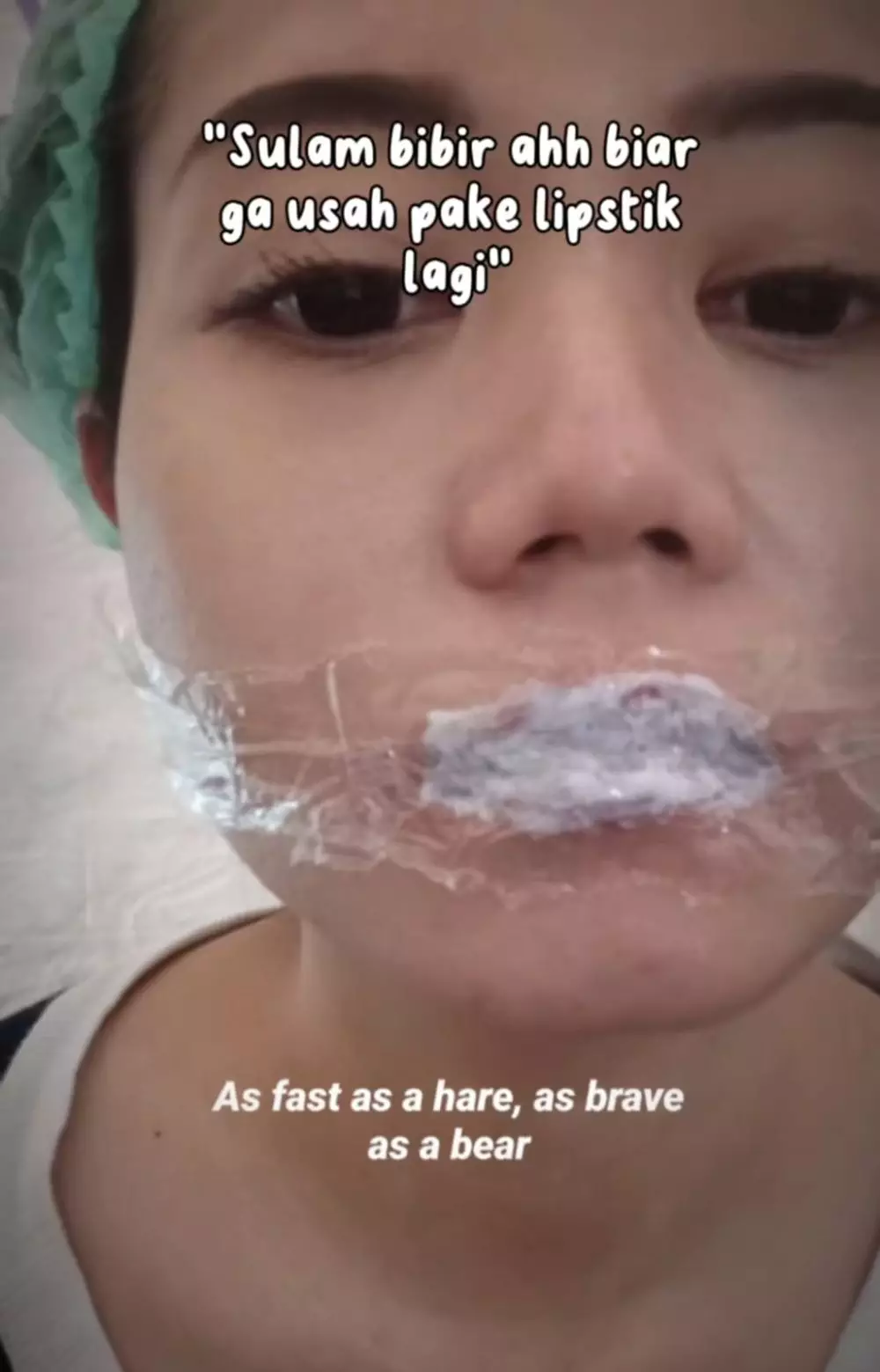 sulam bibir bengkak © TikTok sulam bibir bengkak © TikTok