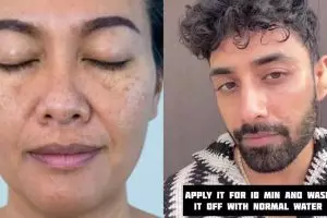 Bukan pakai kentang, ini trik bikin wajah belang dan gelap jadi cerah merata pakai 1 jenis buah