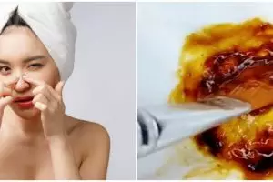 Wajah bebas komedo tanpa lemon, ini cara atasi pori-pori besar dan tersumbat pakai 1 bahan minuman