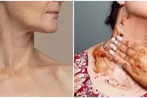 Hasilnya terlihat dalam 7 hari, ini cara atasi garis halus di leher pakai scrub dari 1 bubuk minuman