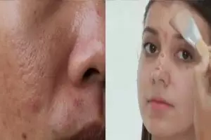 Tanpa tepung beras, ini trik atasi pori-pori besar di wajah kusam dan berminyak pakai 2 jenis buah