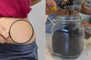 Tanpa beli lotion khusus, ini trik hilangkan stretch marks agar badan tampak mulus pakai 3 bahan dapur