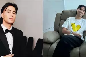 Profesional kerja tak pernah mengeluh, Vidi Aldiano ungkap perjuangannya lawan efek kemo