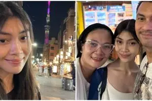 Tak pilih jadi artis, 11 potret terbaru Sasi Asmara putri Anjasmara & Dian Nitami calon dokter bedah