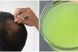 Tanpa aplikasikan serum, ini cara cepat menumbuhkan rambut tipis agar lebat pakai jus 1 jenis buah