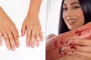 Glowing maksimal tanpa body scrub, ini trik cerahkan kulit tangan hitam pakai 1 jenis buah