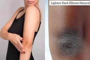 Tak cukup pakai sabun mandi, ini trik memutihkan siku dan lutut hitam pakai 2 bahan dapur