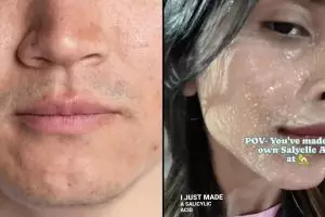 Tanpa serum eksfoliasi, ini trik bikin pori-pori rapat agar wajah tampak mulus pakai 1 jenis buah