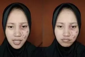 Wajah polos jadi glow up, transformasi makeup wanita bertanda lahir di area mata ini manglingi abis