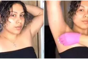 Tak perlu tambahan garam, ini trik atasi kulit ketiak hitam akibat hiperpigmentasi pakai 3 bahan dapur