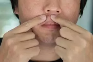 11 Rekomendasi skincare untuk menghilangkan jerawat dan bekasnya merek lokal di bawah Rp 150 ribu