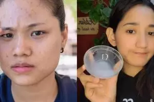 Cara wanita bikin wajah glowing dan kenyal ini cuma butuh 1 jenis minuman, hempas flek dan kulit kusam