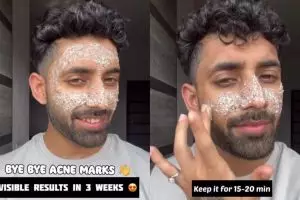 Trik pria hapus jerawat dan bekasnya dalam 3 minggu ini cuma pakai 1 jenis minuman, kulit auto bersih