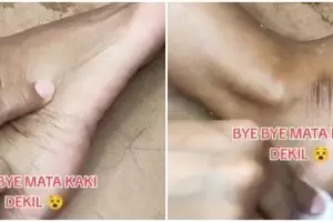 Tak perlu krim pemutih, ini trik atasi mata kaki hitam cuma pakai 1 jenis produk mandi