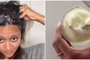 Cuma pakai 2 bahan dapur, cara hilangkan kerak ketombe ala wanita ini bikin kepala bebas gatal