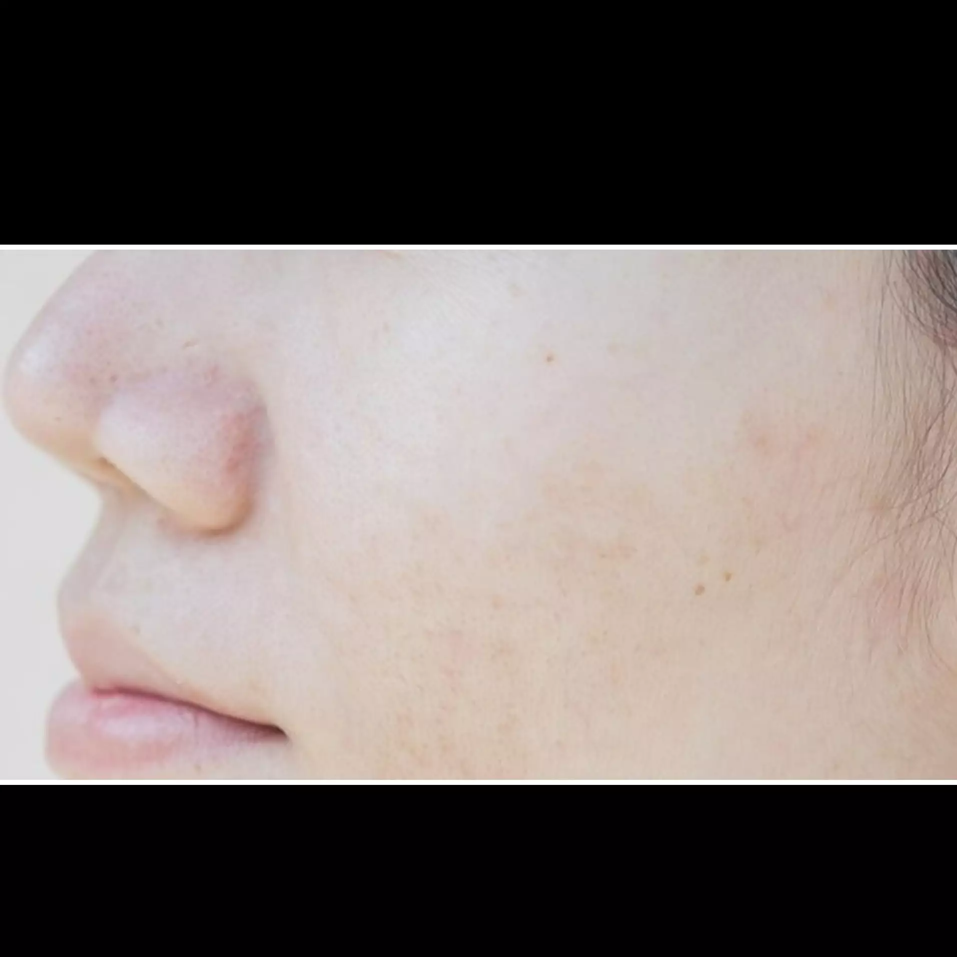 11 Skincare untuk kulit berminyak, berjerawat, dan pori besar merek lokal harga di bawah Rp 200 ribu