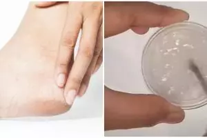 Bukan pakai scrub madu, cara atasi tumit kaki kering dan pecah-pecah agar mulus pakai 2 bahan alami