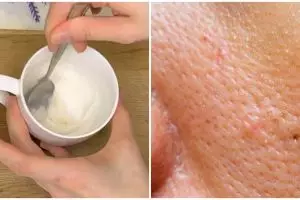 Tanpa aplikasikan scrub, ini cara bikin pori-pori mengecil dan hilangkan kerutan pakai 1 jenis tepung