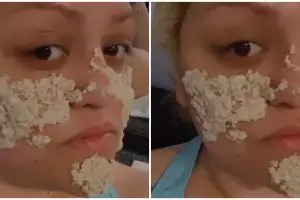 Tanpa serum khusus, trik rapatkan pori-pori besar akibat komedo ala TikToker ini pakai 1 jenis buah