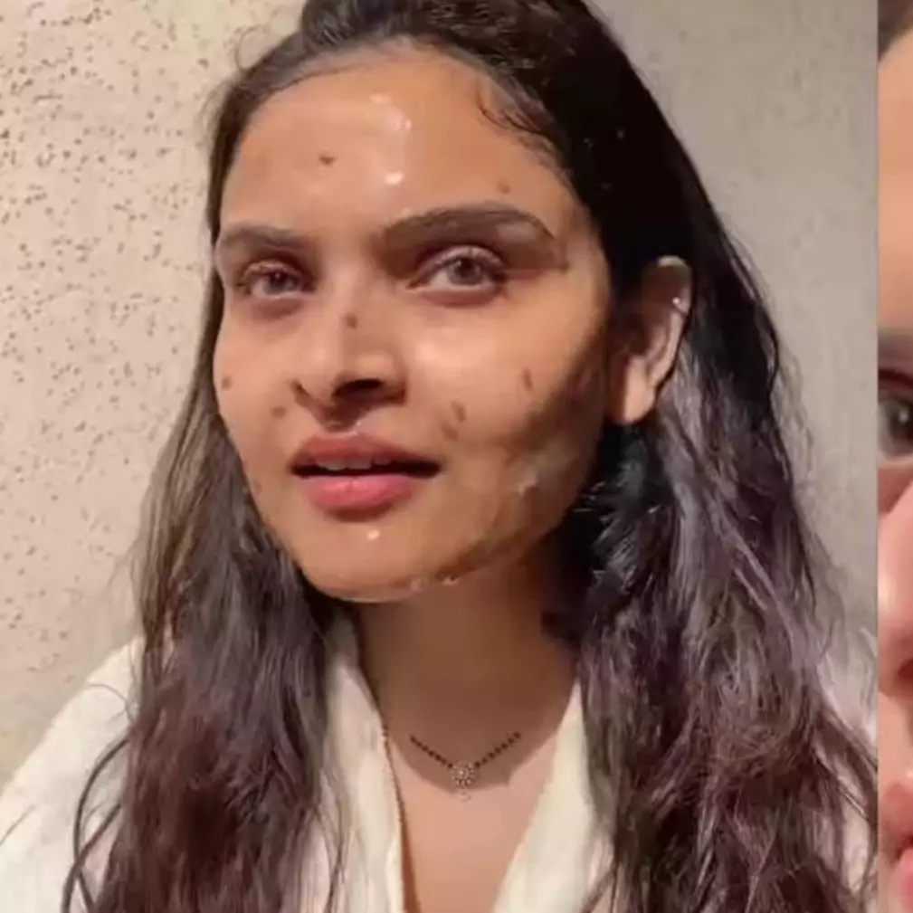 Bukan aloe vera, ini trik bikin masker gel hempas pori-pori terbuka pakai 1 sumber karbohidrat