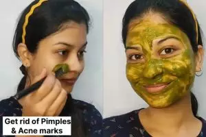 Tak pakai obat totol, intip trik selebgram ini bikin pori bersih bebas jerawat dengan 1 jenis daun