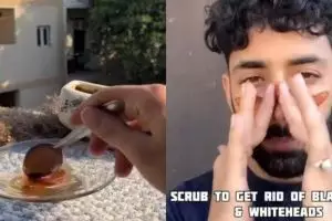 Tanpa toner eksfoliasi, intip trik pria ini bikin wajah bersih dari komedo pakai 2 bahan dapur